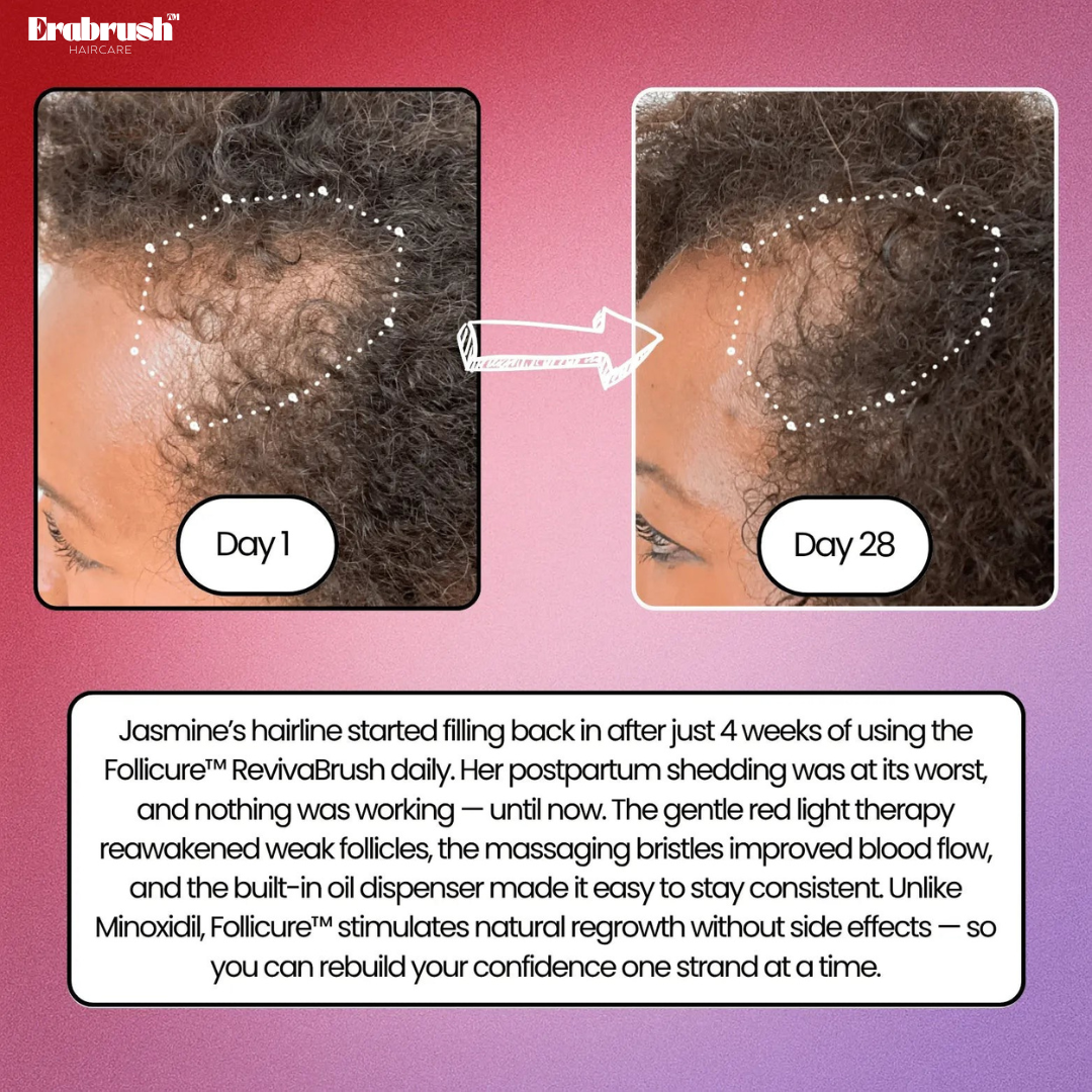 EraBrush™ + Hair Scalp Massager Brush for Hair Growth